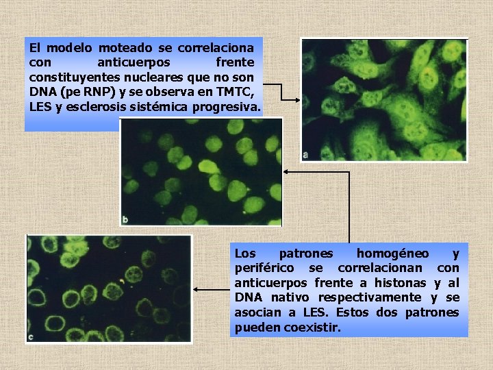 El modelo moteado se correlaciona con anticuerpos frente constituyentes nucleares que no son DNA