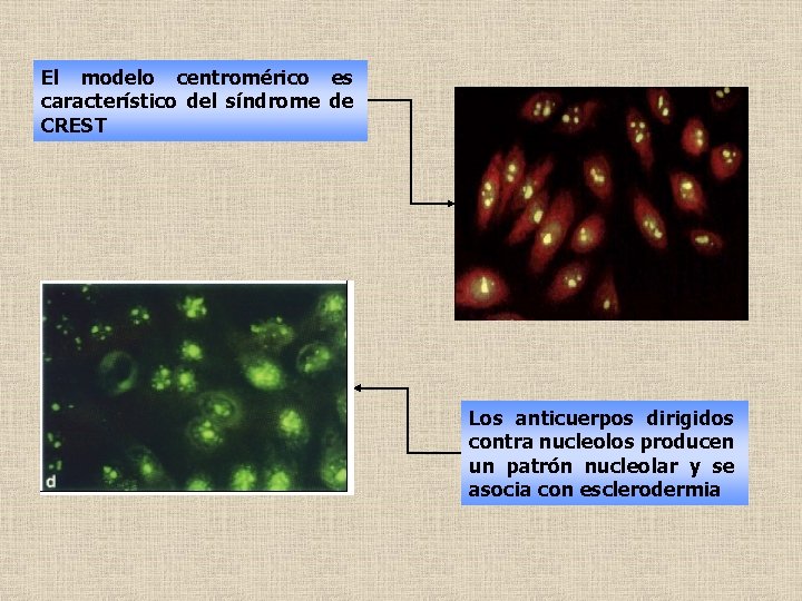 El modelo centromérico es característico del síndrome de CREST Los anticuerpos dirigidos contra nucleolos