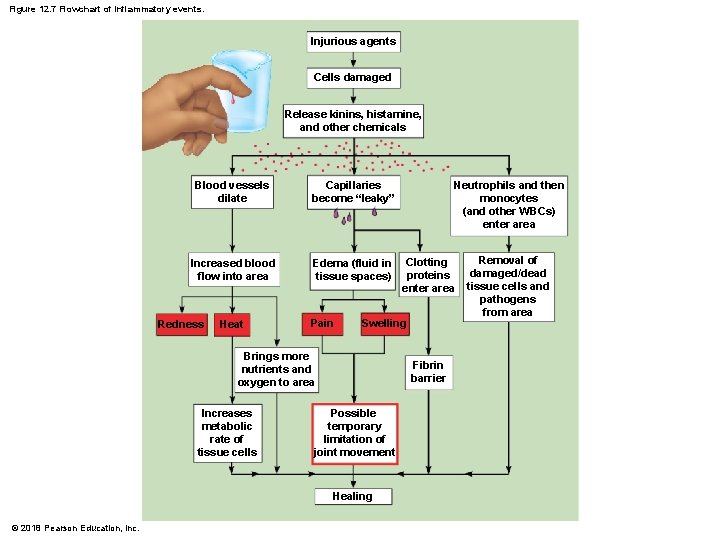 Figure 12. 7 Flowchart of inflammatory events. Injurious agents Cells damaged Release kinins, histamine,