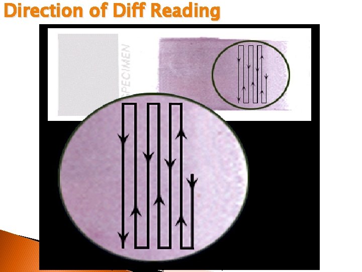 Direction of Diff Reading © 2002 MTS, University of Washington Department of Laboratory Medicine