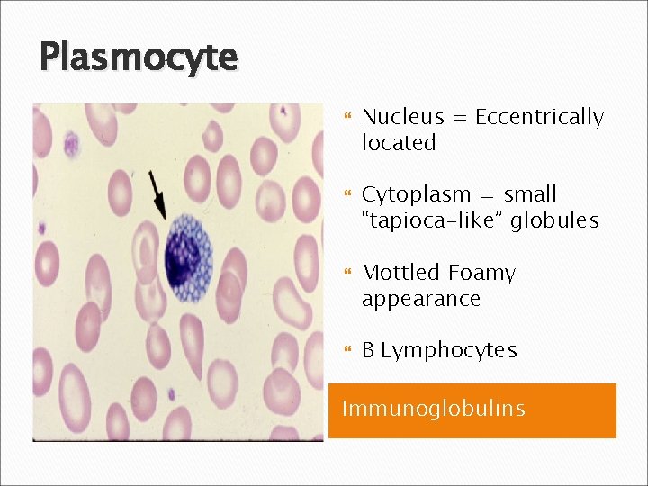 Plasmocyte Nucleus = Eccentrically located Cytoplasm = small “tapioca-like” globules Mottled Foamy appearance B