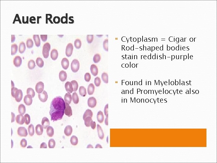 Auer Rods Cytoplasm = Cigar or Rod-shaped bodies stain reddish-purple color Found in Myeloblast