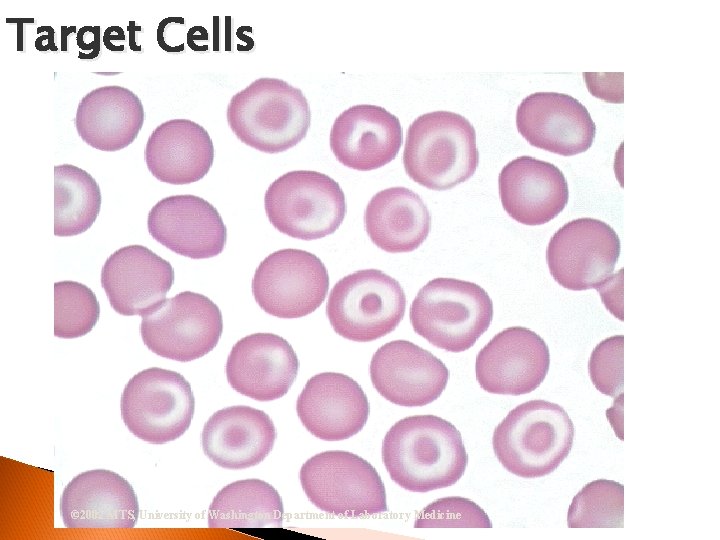 Target Cells © 2002 MTS, University of Washington Department of Laboratory Medicine 