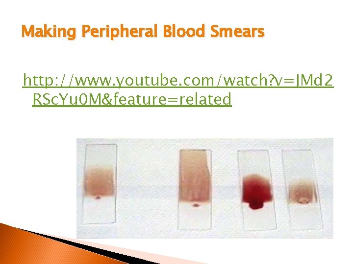 Making Peripheral Blood Smears http: //www. youtube. com/watch? v=JMd 2 RSc. Yu 0 M&feature=related