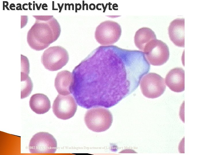 Reactive Lymphocyte © 2002 MTS, University of Washington Department of Laboratory Medicine 