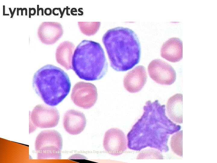 Lymphocytes © 2002 MTS, University of Washington Department of Laboratory Medicine 