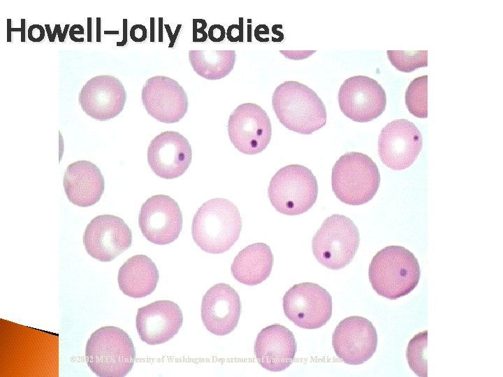 Howell-Jolly Bodies © 2002 MTS, University of Washington Department of Laboratory Medicine 