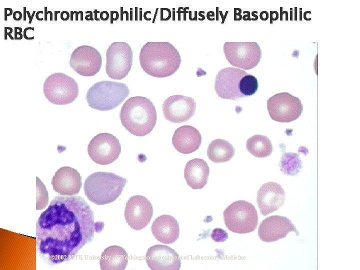 Polychromatophilic/Diffusely Basophilic RBC © 2002 MTS, University of Washington Department of Laboratory Medicine 