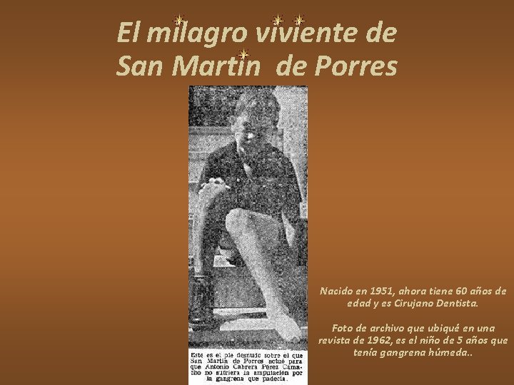 El milagro viviente de San Martín de Porres Nacido en 1951, ahora tiene 60