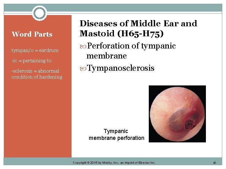 Word Parts tympan/o = eardrum -ic = pertaining to -sclerosis = abnormal condition of