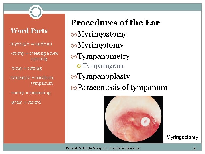 Word Parts myring/o = eardrum -stomy = creating a new opening -tomy = cutting
