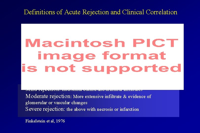 Definitions of Acute Rejection and Clinical Correlation Mild rejection: Interstitial edema and minimal infiltrates Definitions of Acute Rejection and Clinical Correlation Mild rejection: Interstitial edema and minimal infiltrates