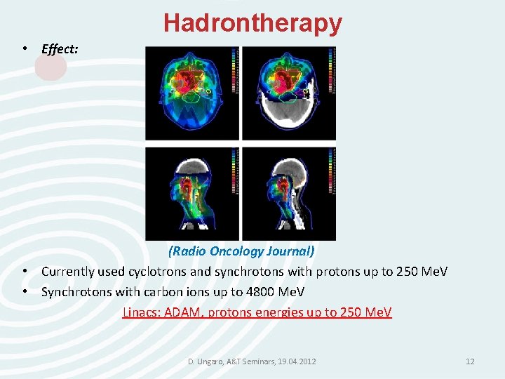 Hadrontherapy • Effect: (Radio Oncology Journal) • Currently used cyclotrons and synchrotons with protons Hadrontherapy • Effect: (Radio Oncology Journal) • Currently used cyclotrons and synchrotons with protons