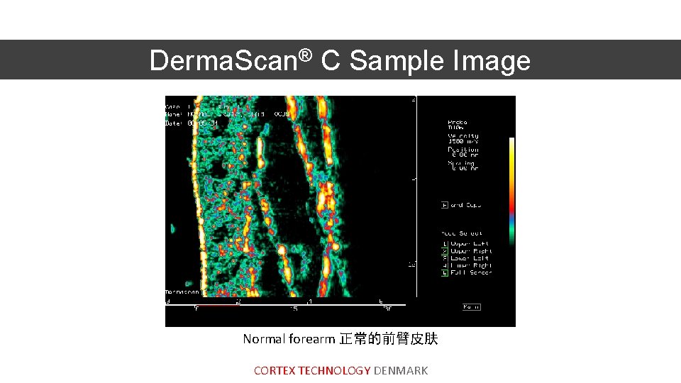 Derma. Scan® C Sample Image Normal forearm 正常的前臂皮肤 CORTEX TECHNOLOGY DENMARK 