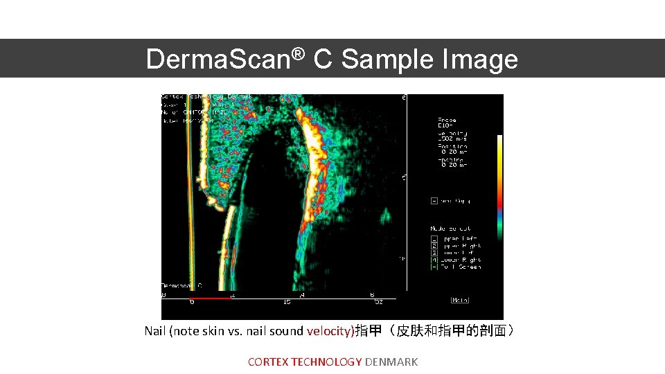 Derma. Scan® C Sample Image Nail (note skin vs. nail sound velocity)指甲（皮肤和指甲的剖面） CORTEX TECHNOLOGY