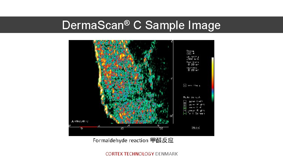 Derma. Scan® C Sample Image Formaldehyde reaction 甲醛反应, back CORTEX TECHNOLOGY DENMARK 