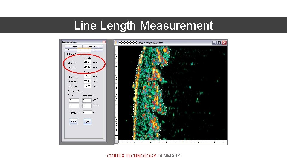 Line Length Measurement CORTEX TECHNOLOGY DENMARK 