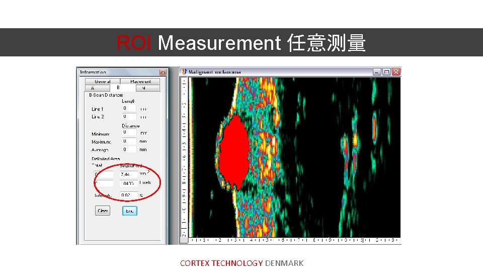 ROI Measurement 任意测量 CORTEX TECHNOLOGY DENMARK 