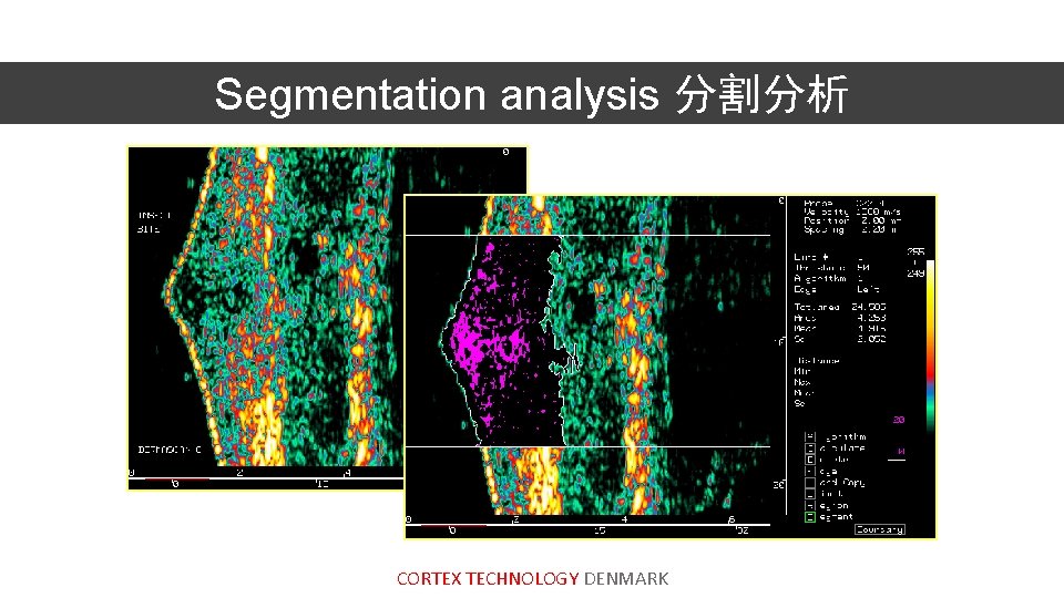 Segmentation analysis 分割分析 CORTEX TECHNOLOGY DENMARK 
