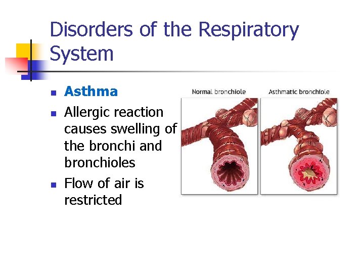 Disorders of the Respiratory System n n n Asthma Allergic reaction causes swelling of