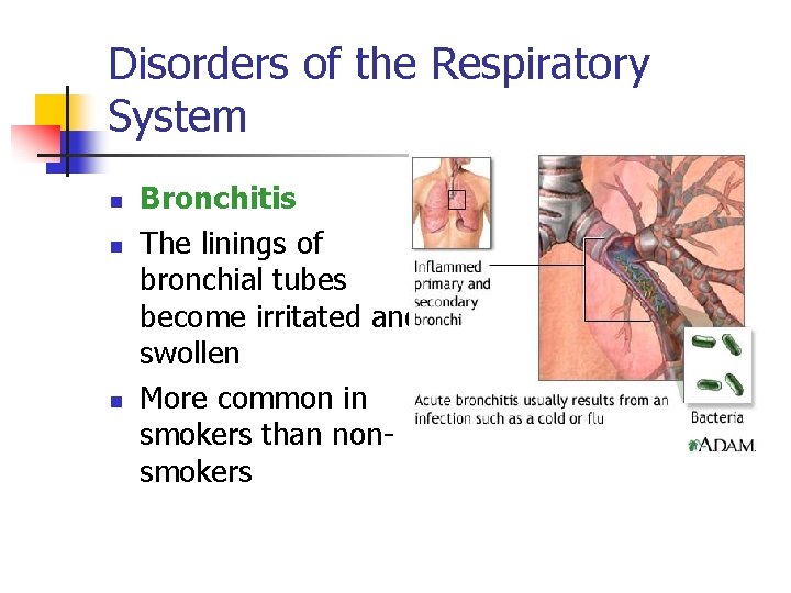 Disorders of the Respiratory System n n n Bronchitis The linings of bronchial tubes