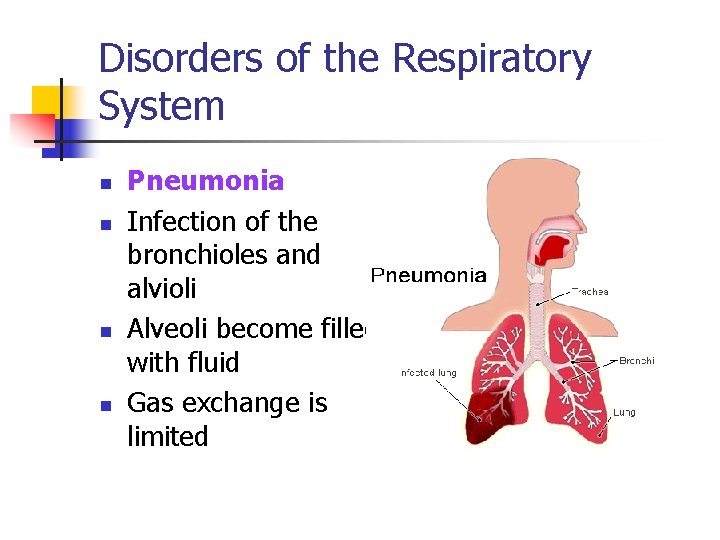 Disorders of the Respiratory System n n Pneumonia Infection of the bronchioles and alvioli