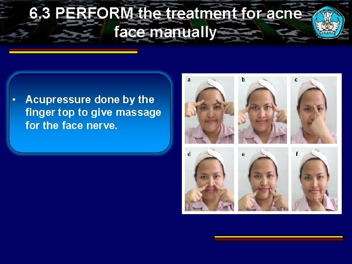 6. 3 PERFORM the treatment for acne face manually • Acupressure done by the