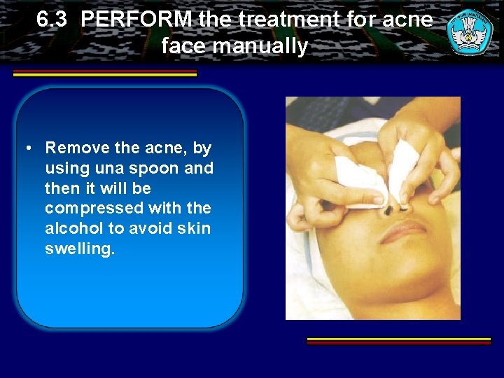 6. 3 PERFORM the treatment for acne face manually • Remove the acne, by
