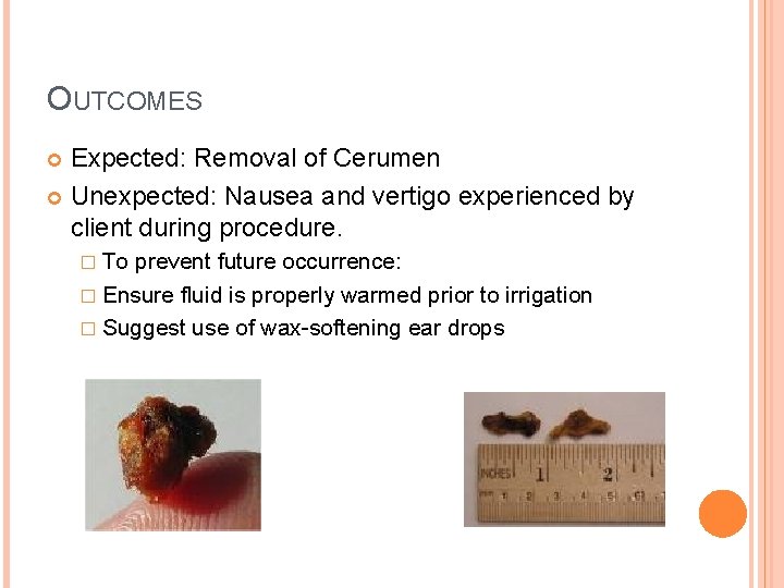 OUTCOMES Expected: Removal of Cerumen Unexpected: Nausea and vertigo experienced by client during procedure.