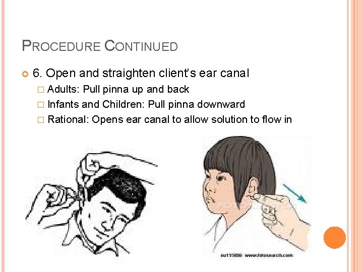 PROCEDURE CONTINUED 6. Open and straighten client’s ear canal � Adults: Pull pinna up