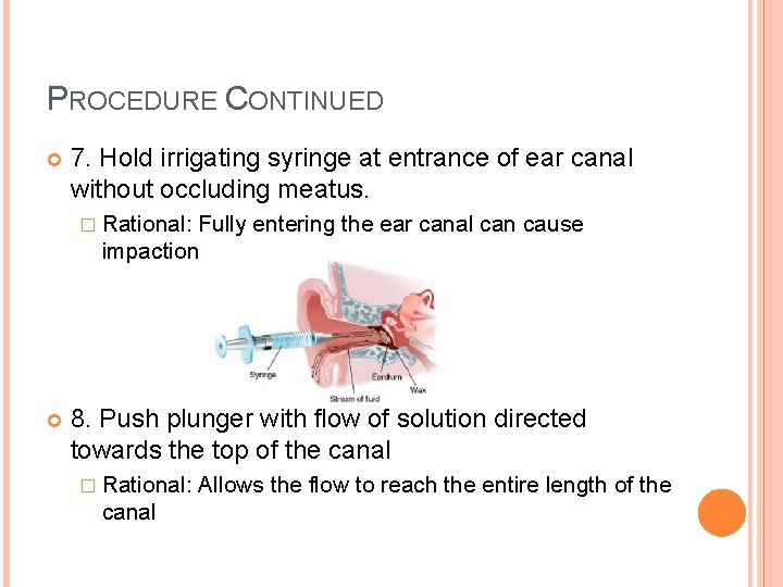 PROCEDURE CONTINUED 7. Hold irrigating syringe at entrance of ear canal without occluding meatus.