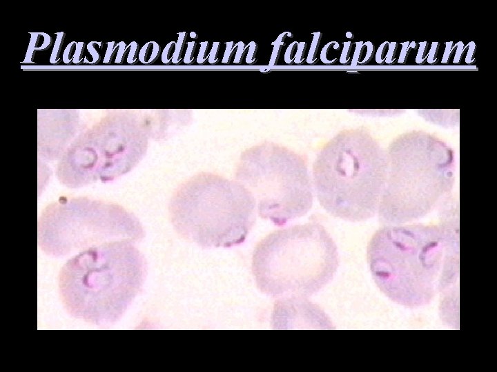 Plasmodium falciparum 