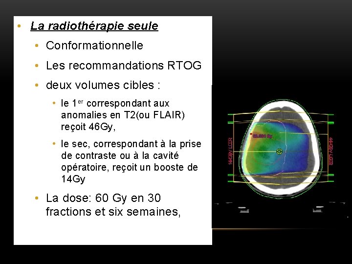  • La radiothérapie seule • Conformationnelle • Les recommandations RTOG • deux volumes