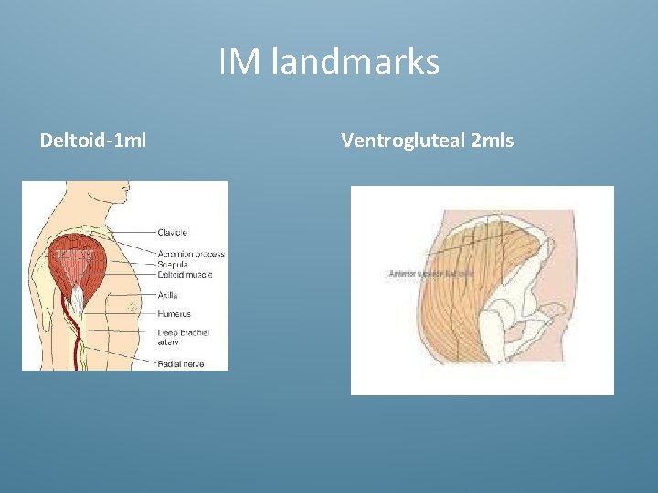 IM landmarks Deltoid-1 ml Ventrogluteal 2 mls 