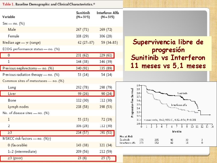 Supervivencia libre de progresión Sunitinib vs Interferon 11 meses vs 5, 1 meses 