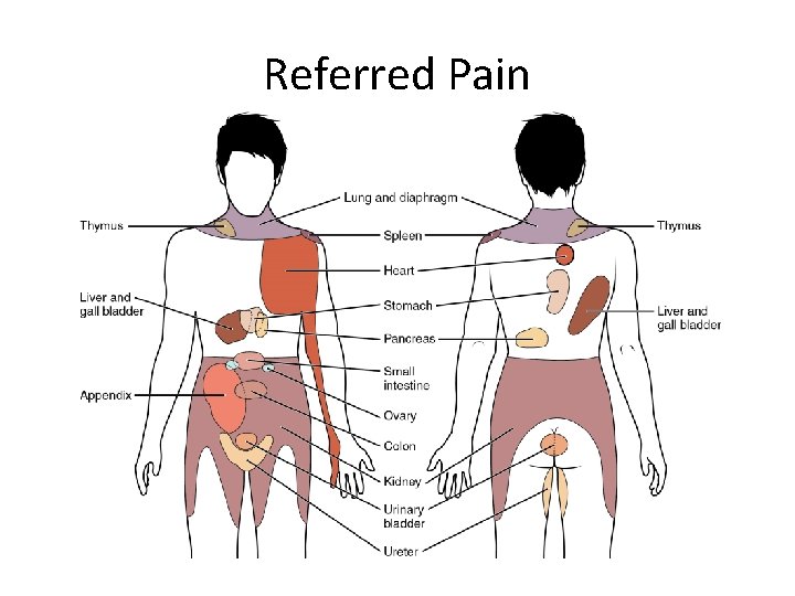 Referred Pain 