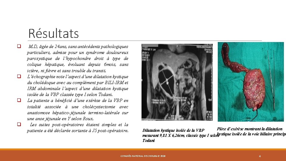Résultats q q M. D, âgée de 24 ans, sans antécédents pathologiques particuliers, admise Résultats q q M. D, âgée de 24 ans, sans antécédents pathologiques particuliers, admise