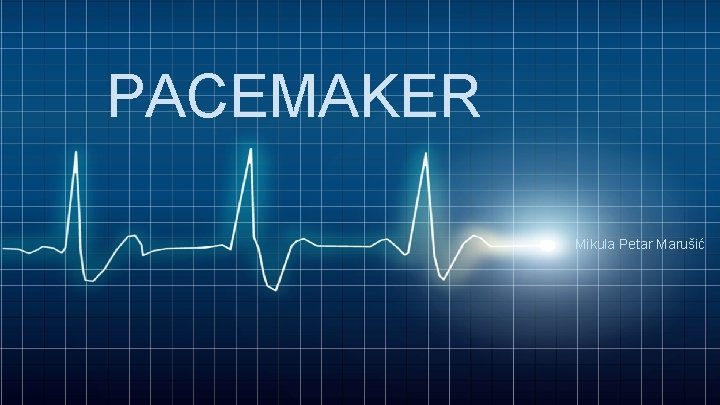 PACEMAKER Mikula Petar Marušić 