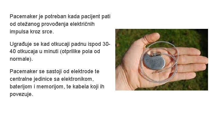 Pacemaker je potreban kada pacijent pati od otežanog provođenja električnih impulsa kroz srce. Ugrađuje