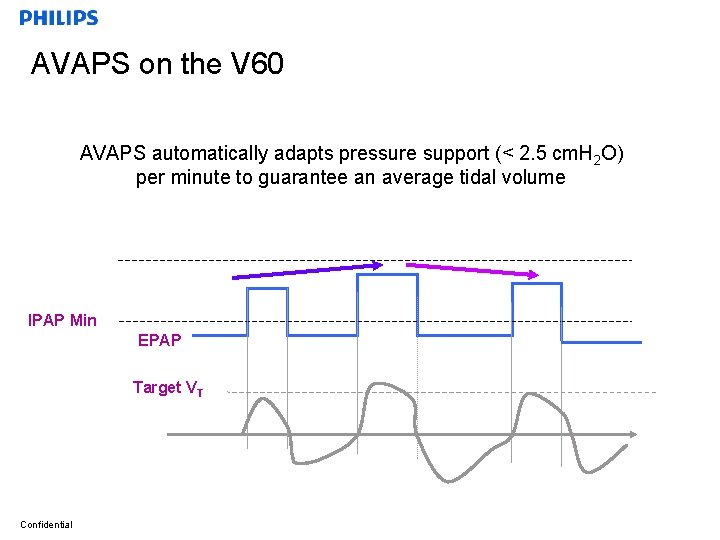 AVAPS on the V 60 AVAPS automatically adapts pressure support (< 2. 5 cm.
