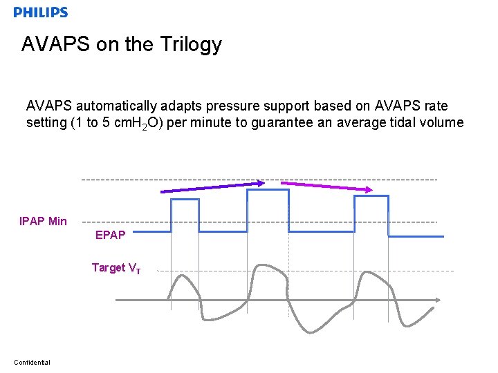 AVAPS on the Trilogy AVAPS automatically adapts pressure support based on AVAPS rate setting
