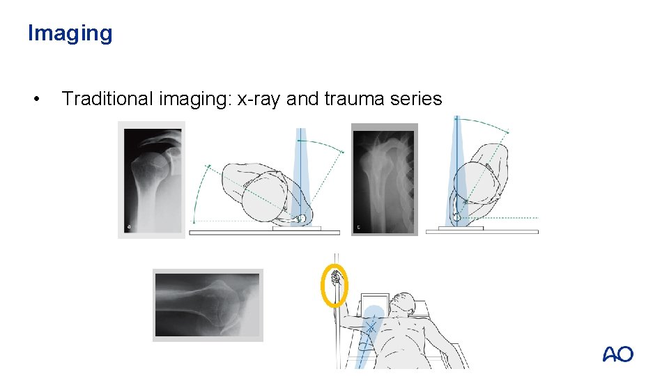 Imaging • Traditional imaging: x-ray and trauma series 