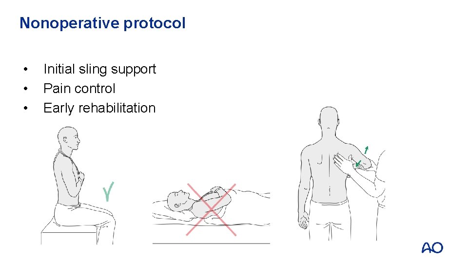 Nonoperative protocol • • • Initial sling support Pain control Early rehabilitation 