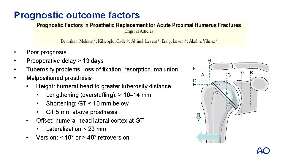 Prognostic outcome factors • • Poor prognosis Preoperative delay > 13 days Tuberosity problems: