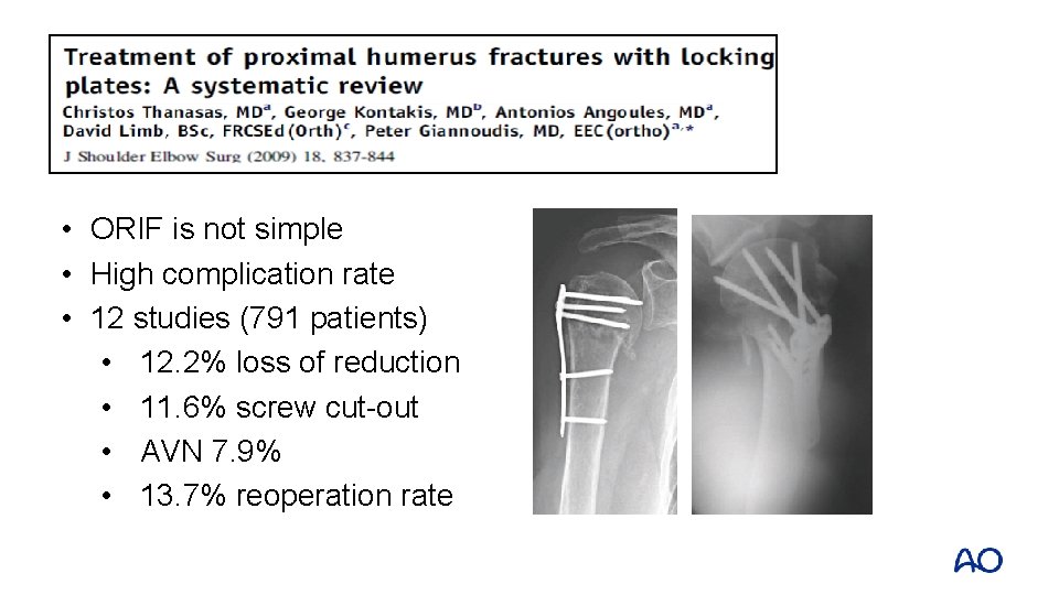  • ORIF is not simple • High complication rate • 12 studies (791