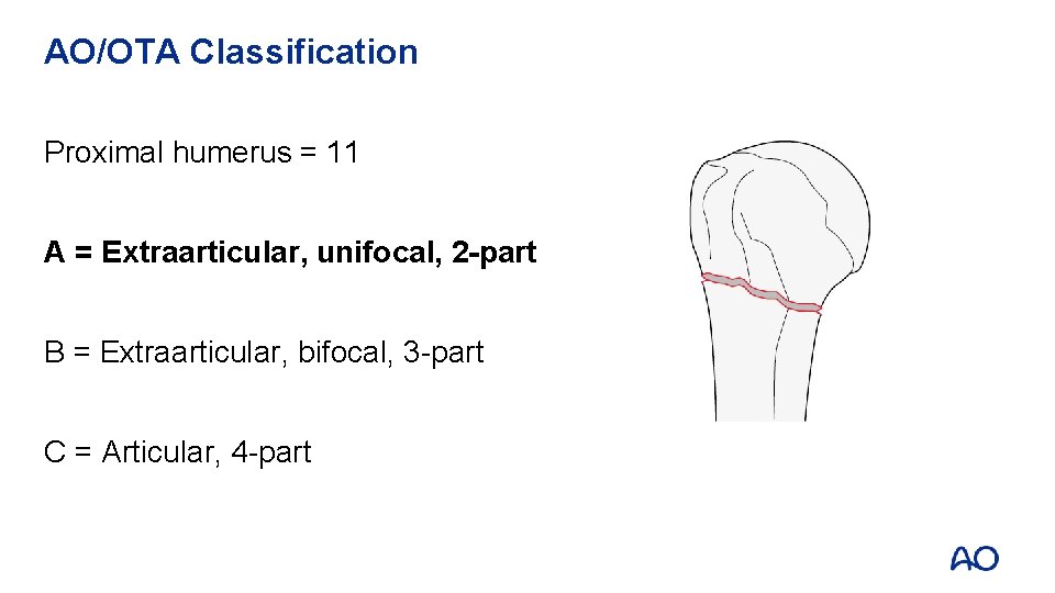 AO/OTA Classification Proximal humerus = 11 A = Extraarticular, unifocal, 2 -part B =