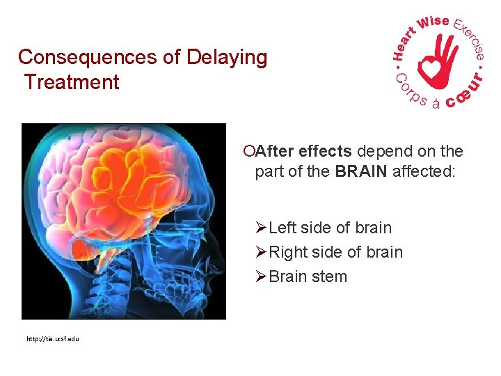 Consequences of Delaying Treatment ¡After effects depend on the part of the BRAIN affected: