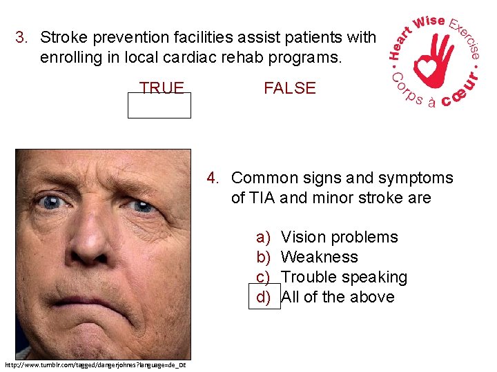 3. Stroke prevention facilities assist patients with enrolling in local cardiac rehab programs. TRUE