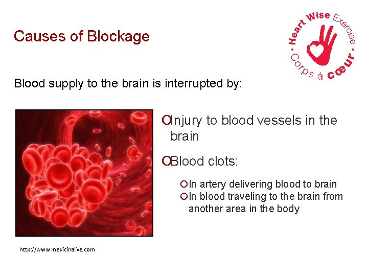Causes of Blockage Blood supply to the brain is interrupted by: ¡Injury to blood