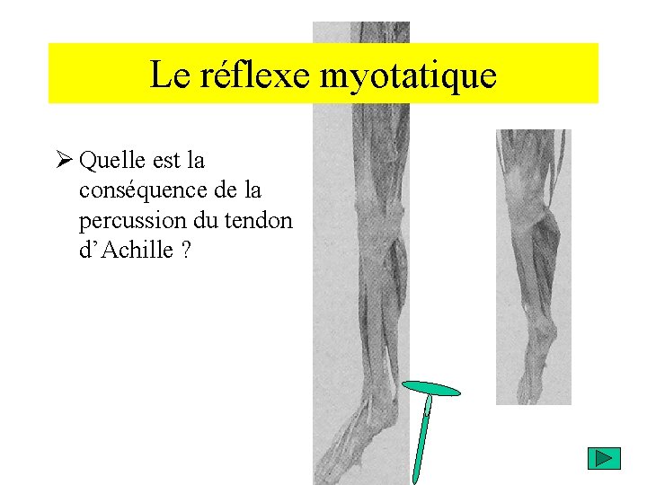 Le réflexe myotatique Ø Quelle est la conséquence de la percussion du tendon d’Achille